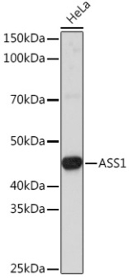 Вестерн-блот анализ экстрактов клеток HeLa с использованием ASS1 Rabbit pAb (A16767) в разведении 1:3000.