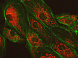 Фиксированные опухолевые клетки, экспрессирующие GFP