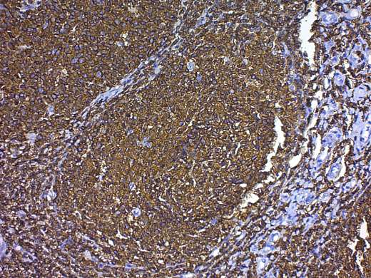 Буфер цитратный, 100х-кратный, для восстановления антигенных свойств, рН 6.0
