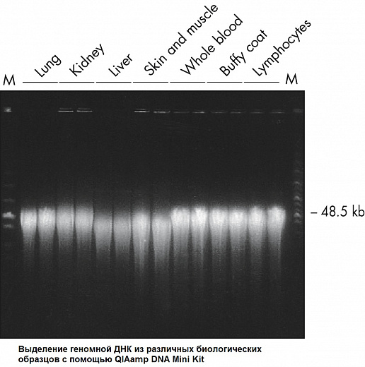 Набор для выделения ДНК из широкого спектра биологических образцов QIAamp DNA Mini Kit Фото 2