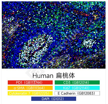 Набор для многоцветного флуоресцентного окрашивания с 6 метками и 7 цветами TSAPLus, Servicebio, Китай