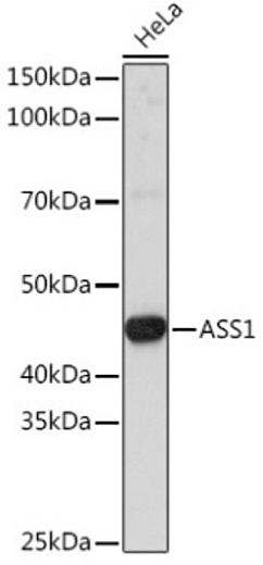 Вестерн-блот анализ экстрактов клеток HeLa с использованием ASS1 Rabbit pAb (A16767) в разведении 1:3000